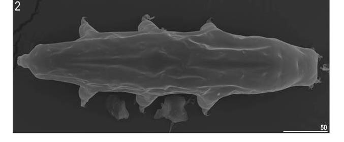 Mesobiotusphilippinicus, the first land-based tardigrade reported from the Philippines.